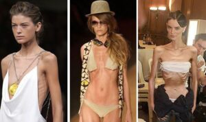 modelle magre anoressiche